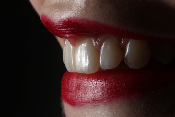Как часто можно делать отбеливание зубов