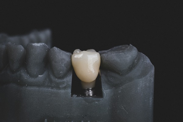Почему на зубной эмали появляются трещины